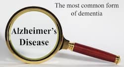 Did you know? Immune system may cure Alzheimer's disease