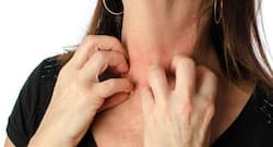 गर्मी के मौसम में खुजली वाली घमौरियों से कैसे बचें ?