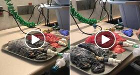 Watch: This viral video shows the difference between smoker's and non-smoker's lungs