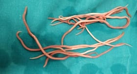 Roundworms avoid bad bacteria after smelling Nitric oxide, concludes study Roundworms avoid bad bacteria after smelling Nitric oxide, concludes study