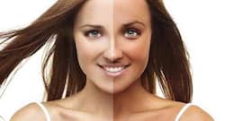 सनबर्न से त्वचा की खूबसूरती खो तो नहीं गई, यूं करें देखभाल