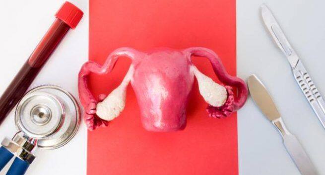 6 ways to manage PCOS better to get pregnant and live a healthy life