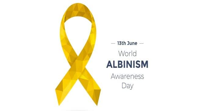 International Albinism Awareness Day 2018: Myths and treatment options