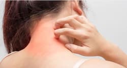 Top 6 anti-allergy superfoods to the rescue