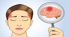Brain Tumour : लगातार रहता है सिरदर्द तो हो सकता है ब्रेन ट्यूमर, जानें इसके लक्षण, कारण और उपचार
