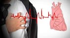 Heart arrhythmia: Signs that indicate serious cardiac health problems