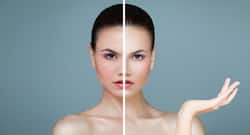 A dermatologist explains how to deal with open pores