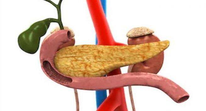 pancreatic cancer
