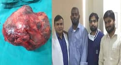 Doctors remove retroperitoneal tumour from 32-year-old Ethiopian patient giving him a second chance to life