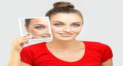 Out damn spot: 5 natural ways to banish those dark patches