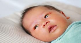 Everything you need to know about neonatal jaundice