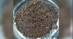 Doctors remove 3,000 kidney stones from a woman