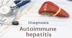 वर्ल्ड हेपेटाइटिस डे 2018 : ''ऑटोइम्यून हेपेटाइटिस'' लीवर के लिए हो सकता है खतरनाक