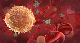 Rajiv Gandhi Cancer Institute and Research Centre to launch awareness drive for Sarcoma cancer