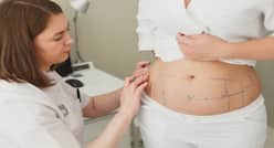 5 Common Myths About Liposuction Busted