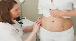 5 Common Myths About Liposuction Busted