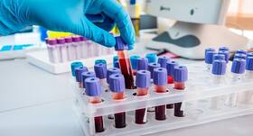 Indian doctors discover new rare blood group after Nigeria's progress on quick detection of sickle cell anaemia