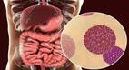 Rotavirus