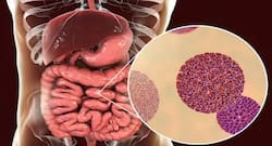 रोटावायरस से बच्चे की जा सकती है जान, जानें रोटावायरस के लक्षण व उपचार