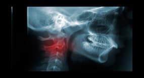 Head and neck cancer treatment: Here are the most effective options