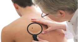 Men more likely to die of skin cancer than women: Know why