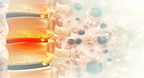Spinal cord tumour is shooting up quick with no known reasons of its occurrence