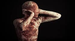 हादसों के शिकार लोगों की चिकित्सा पर आर्थोपेडिक एसोसिएशन का सम्मेलन रविवार को