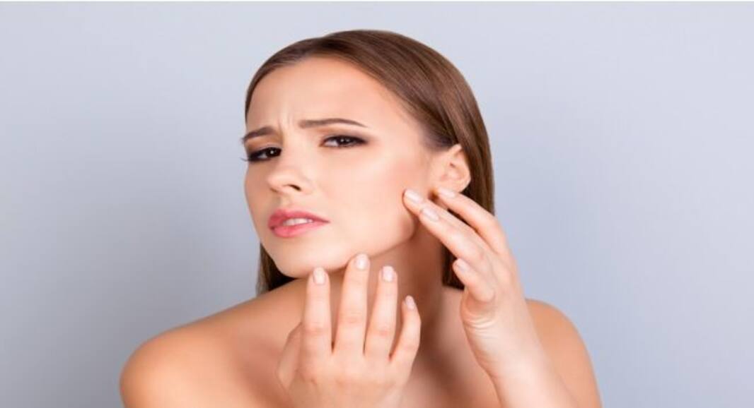 Oily skin: Follow these fool-proof tricks