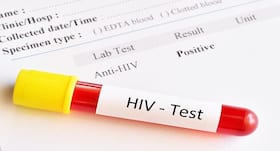 53% of HIV patients in Maharashtra who have stopped treatment are missing, says report 53% of HIV patients in Maharashtra who have stopped treatment are missing, says report