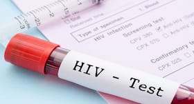 Parliamentary committee notifies health ministry to speed up setting of ART centres for HIV patients