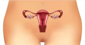 Know if using contraceptives reduce ovarian cancer risk Know if using contraceptives reduce ovarian cancer risk