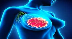Now scientists bring in another new breakthrough in breast cancer treatment