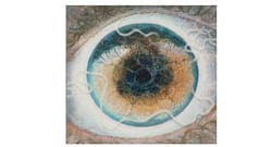 An artist draws a haunting image of an inch-long worm in his eye