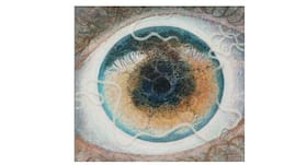 An artist draws a haunting image of an inch-long worm in his eye