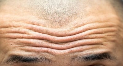 5 effective ways to erase forehead wrinkles | TheHealthSite.com