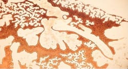 खोपड़ी और मस्तिष्क के बीच हुई गुप्त सुरंगों की खोज