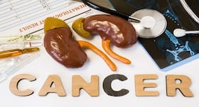 5 signs that tell you may have kidney cancer