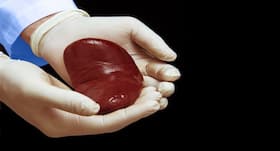 Bengal kidney recipient dies post transplant after her body rejected the new organ