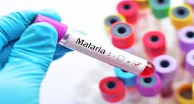 Diet for malaria: What you should and what not