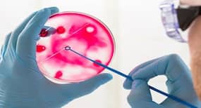 Petri dish might hold the key to recovery from traumatic brain injury