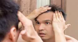 Want to treat scalp acne?  Go au naturel