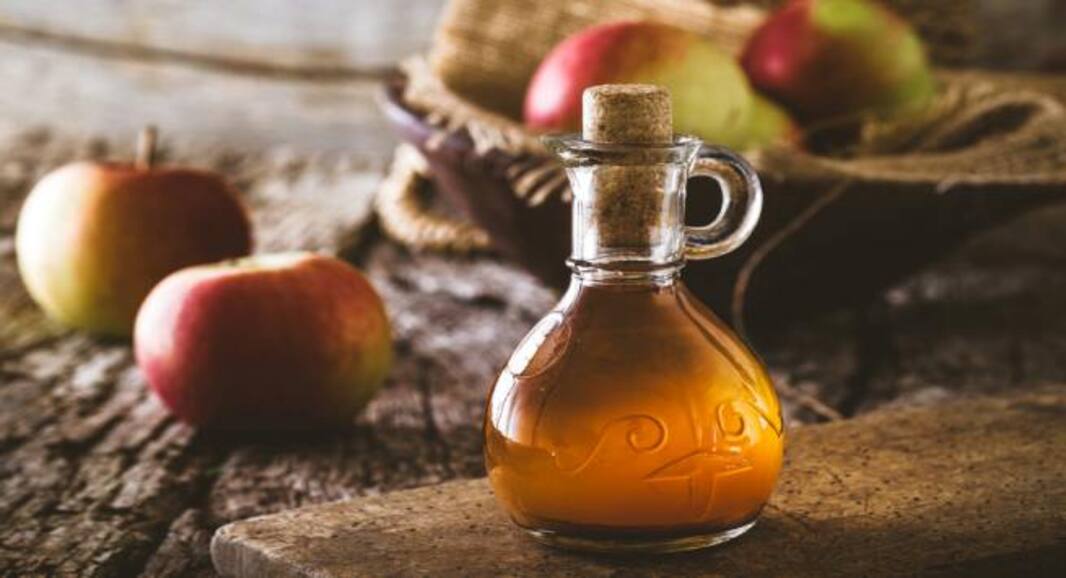 5 best home remedies to treat dandruff