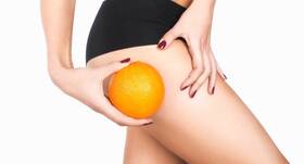 4 reasons why cellulite is more common in women than men