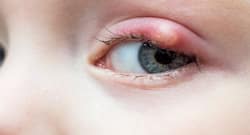 3 odd things that your eyes can develop