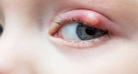 3 odd things that your eyes can develop