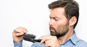 Baldness affects men physically and emotionally