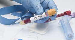 What to do if your PSA levels are high?