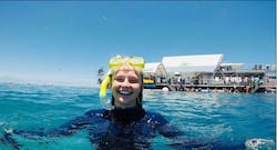 Skin cancer from biting nails: 20-year-old Australian girl’s thumb amputated after getting rare cancer