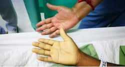 महिलाएं ही नहीं, पुरुषों में भी होती है आयरन की कमी, ये हो सकता है नुकसान