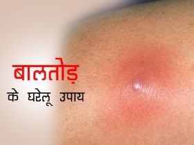 बालतोड़ क्यों होता है? जाने इसके 5 बेहतरीन घरेलू उपचार